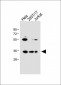 BCKDHB Antibody (N-term)